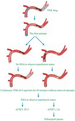 Intra-arterial tenecteplase is safe and may improve the first-pass recanalization for acute ischemic stroke with large-artery atherosclerosis: the BRETIS-TNK trial